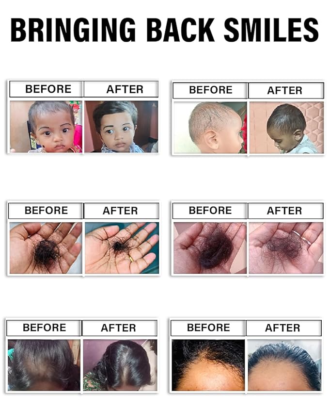 100ml Paati hair oil